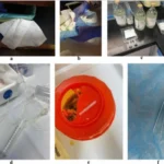 Medical Waste Classification & Pre-Treatment Comparison Europe vs China vs Africa